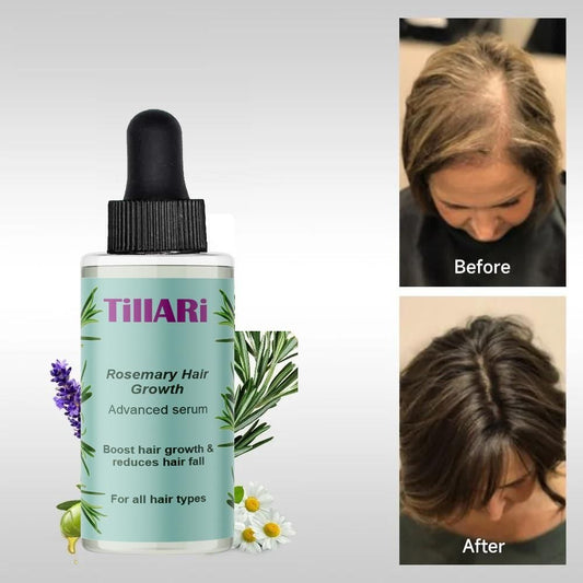Tillari Rosemary Hair Growth Serum