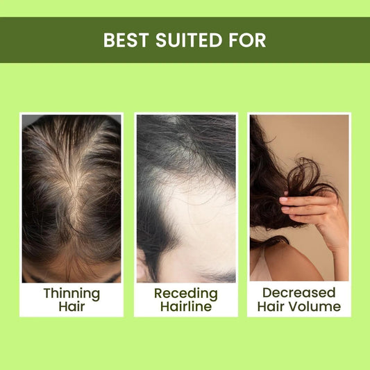 Rosemary Water Spray For Hair Regrowth | Men and Women | (Buy 1 Get 2 Free) | Limited Time Offer | Hurry Up